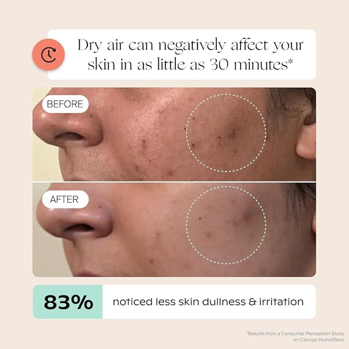 Canopy Bedside Humidifier 2.0, White, 36 HR Run Time, 2.5L Capacity - Reading Light & White Noise - Alleviate Symptoms of Allergies, Flu, Cold, Dry Skin - Humidifier, Filter, Power Cord & Adapter