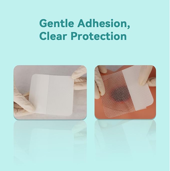 Dimora Silicone Wound Contact Layer, Non-adhering Dressing, Transparent Wound Dressing Pads, 3in x 4in (7.5cm x 10cm), 10 pcs