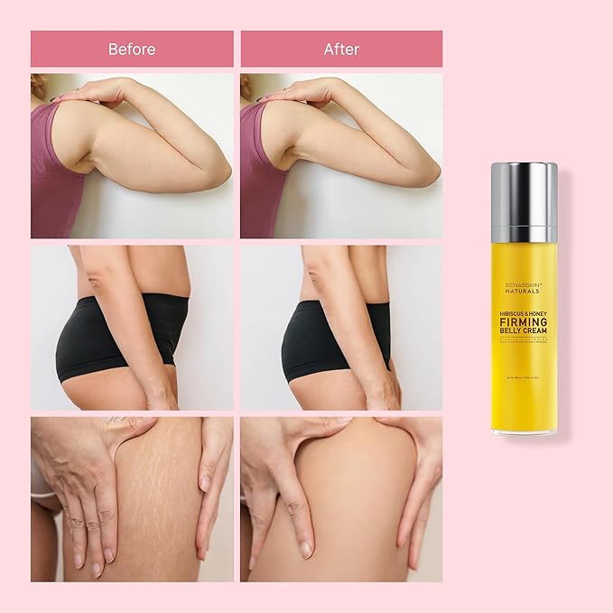 Enaskin Naturals Belly Firming & Skin Tightening Cream — Hibiscus and Honey Cellulite Lotion for Stomach, Thighs & Butt — Moisturizing & Lifting Body Lotion for Women, 100ML